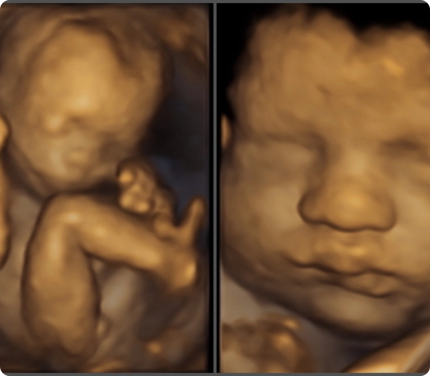 2 Visit Ultrasound Package 1