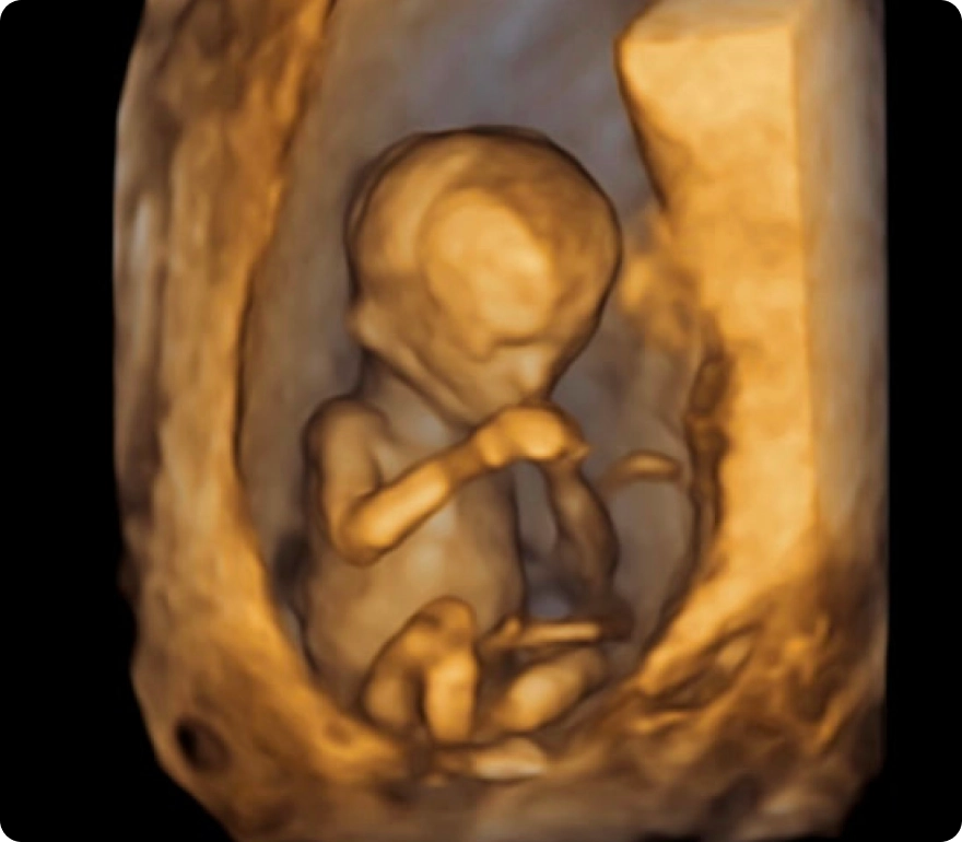 The Basic Ultrasound Package